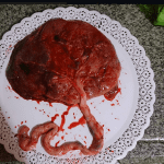 parto humanizado muerte bebe san luis belen weber 1